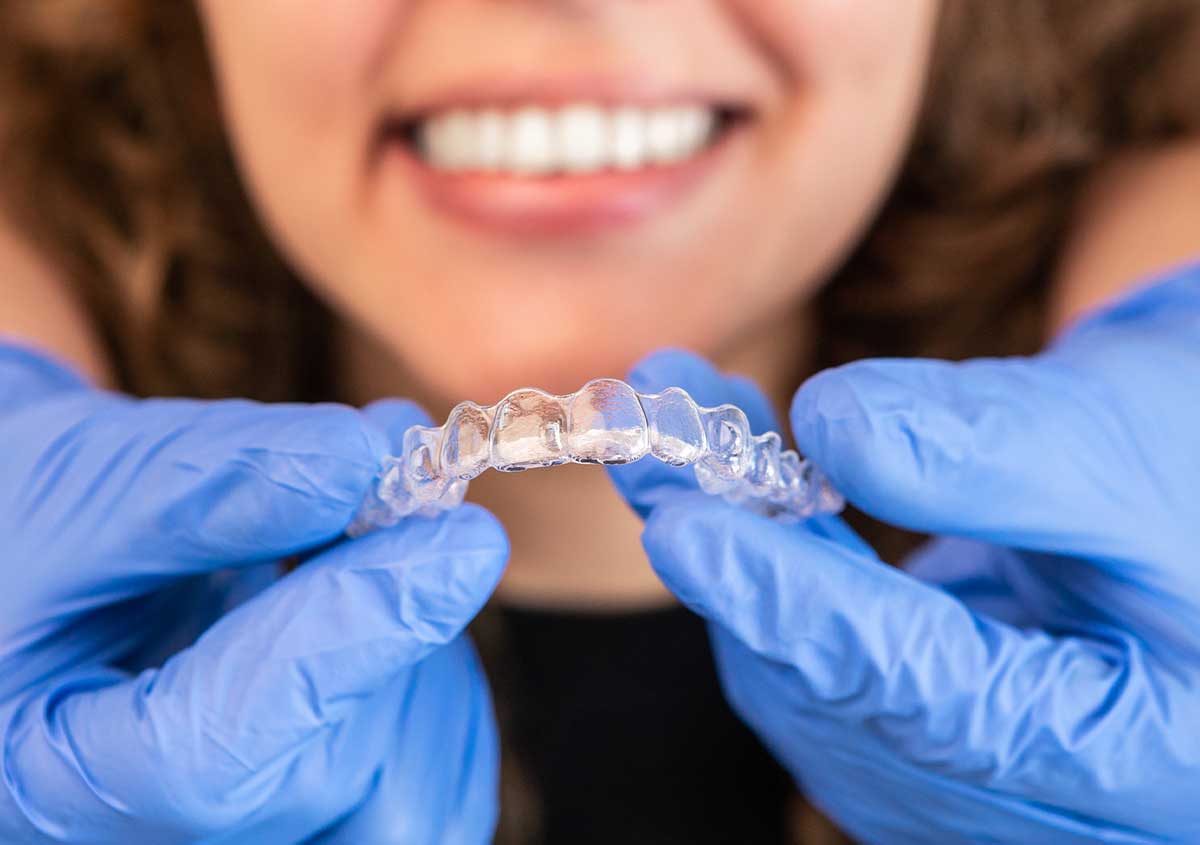 Invisalign for Overlapping Teeth in Austin, TX Area